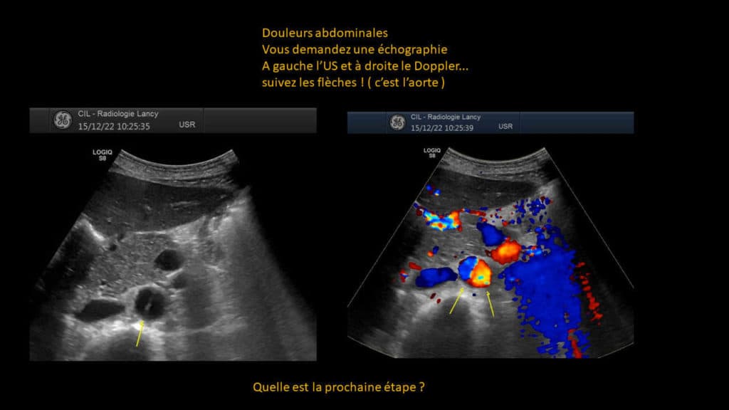 Présentation clinico- radiologique 03