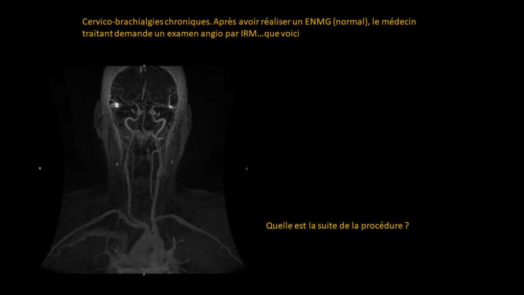Présentation clinico- radiologique 04