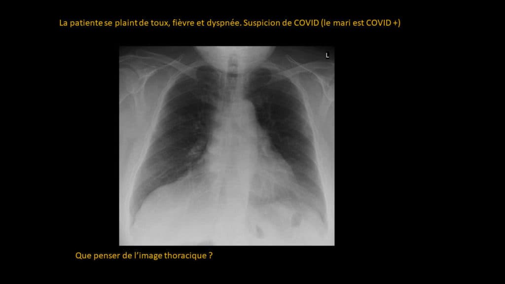 Présentation clinico- radiologique 05