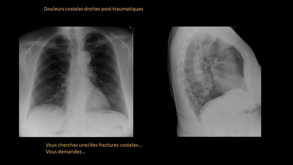 Présentation clinico- radiologique 06