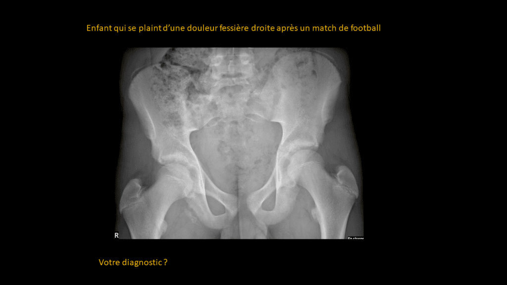 Présentation clinico- radiologique 02