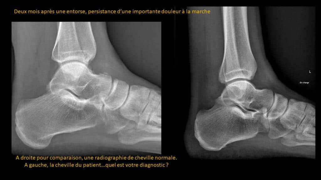 Présentation clinico- radiologique 01