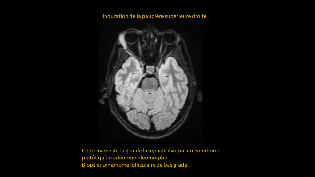 Réponse cerveau