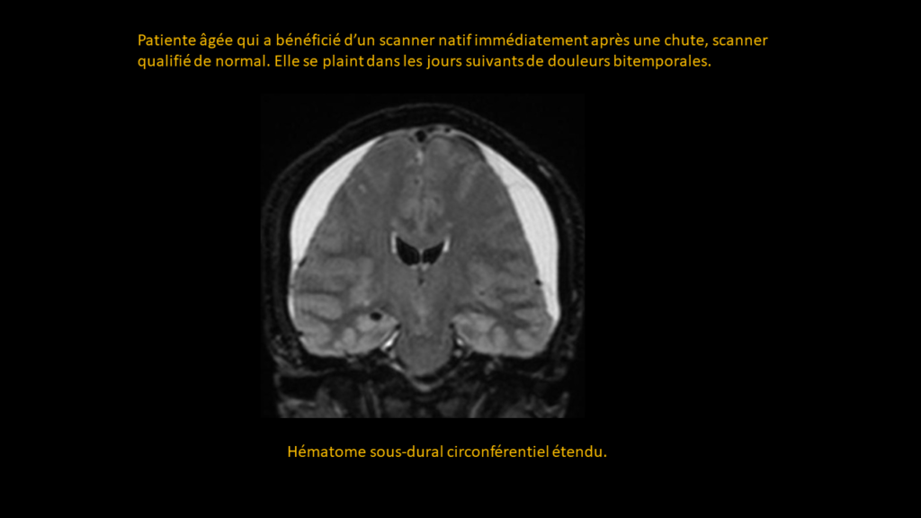 Réponse HSD